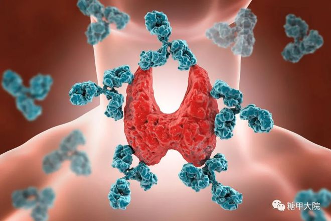 突破性治疗攻略：揭秘桥本甲状腺炎全新治愈之道