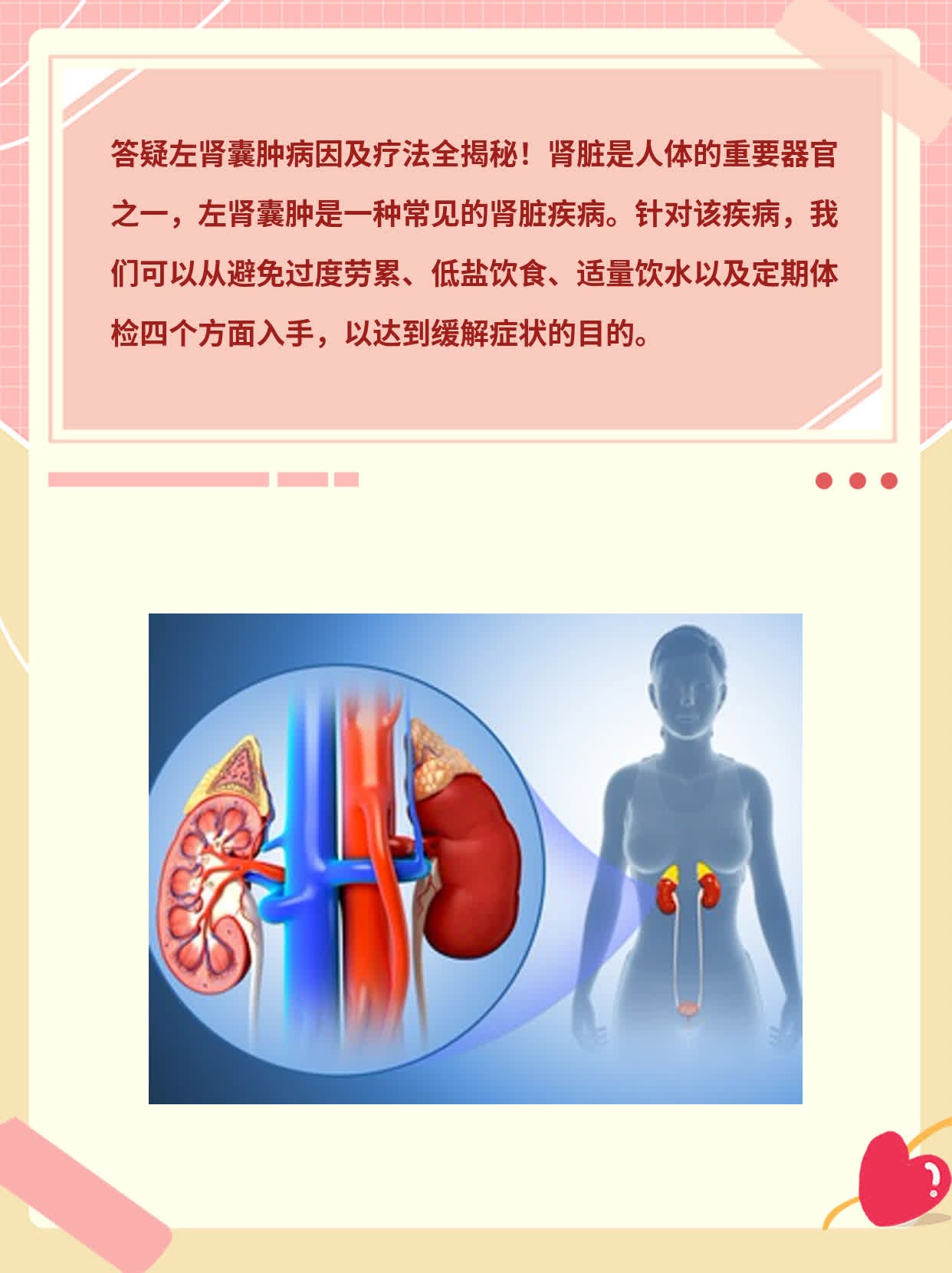 探寻前沿：肾囊肿治疗领域的最新突破与先进技术